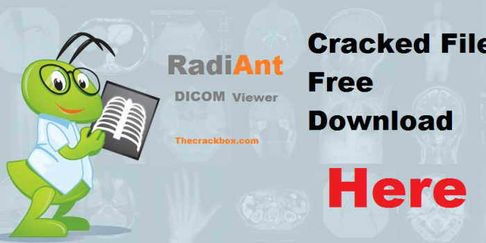 RadiAnt DICOM Viewer Crack