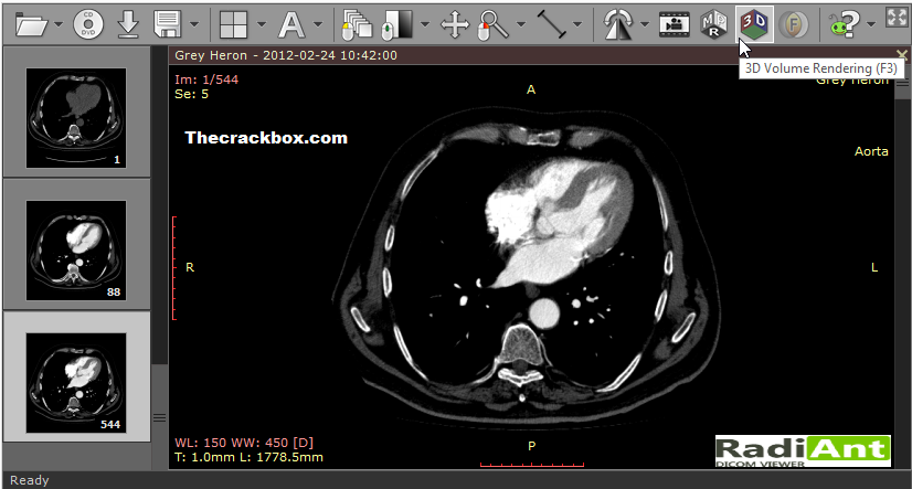 RadiAnt DICOM Viewer Keygen